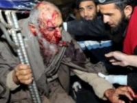 Взрыв в Пакистане:есть погибшие и раненые. Раменский хирургический