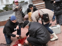 Тяжелораненная женщина перед входом в управление СБУ. Фото: fakty.ictv.ua. Халатность должностного лица